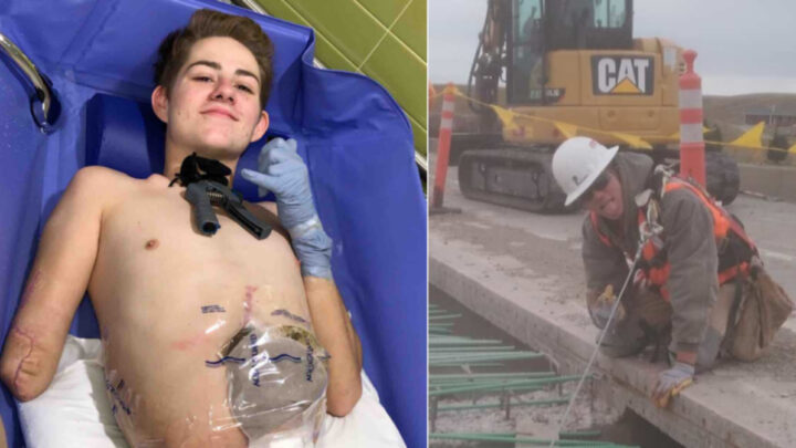 Man Loses Half of His Body in a Forklift Crash at a Construction Site